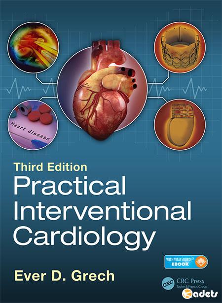 Practical Interventional Cardiology